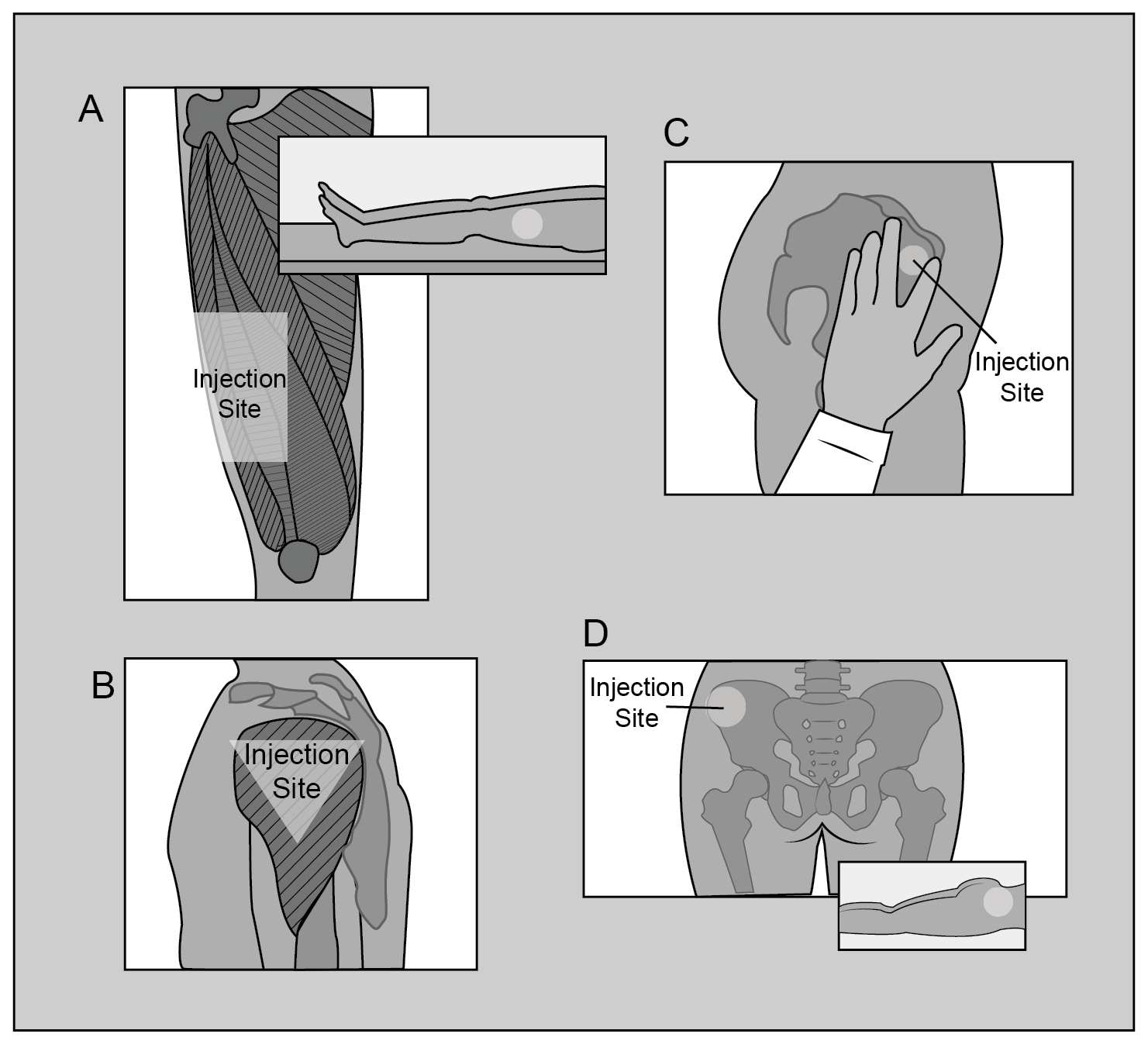 identify each intramuscular injection site on the diagram using the corresponding letter.