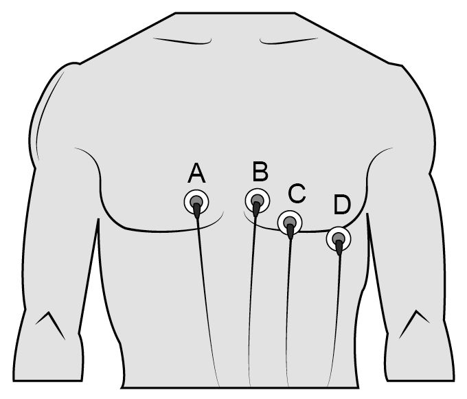 The nurse is preparing to do a 12-lead ECG on a client. Which of the following shows where the V1 lead should be placed?